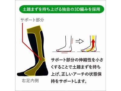 アーチサポート